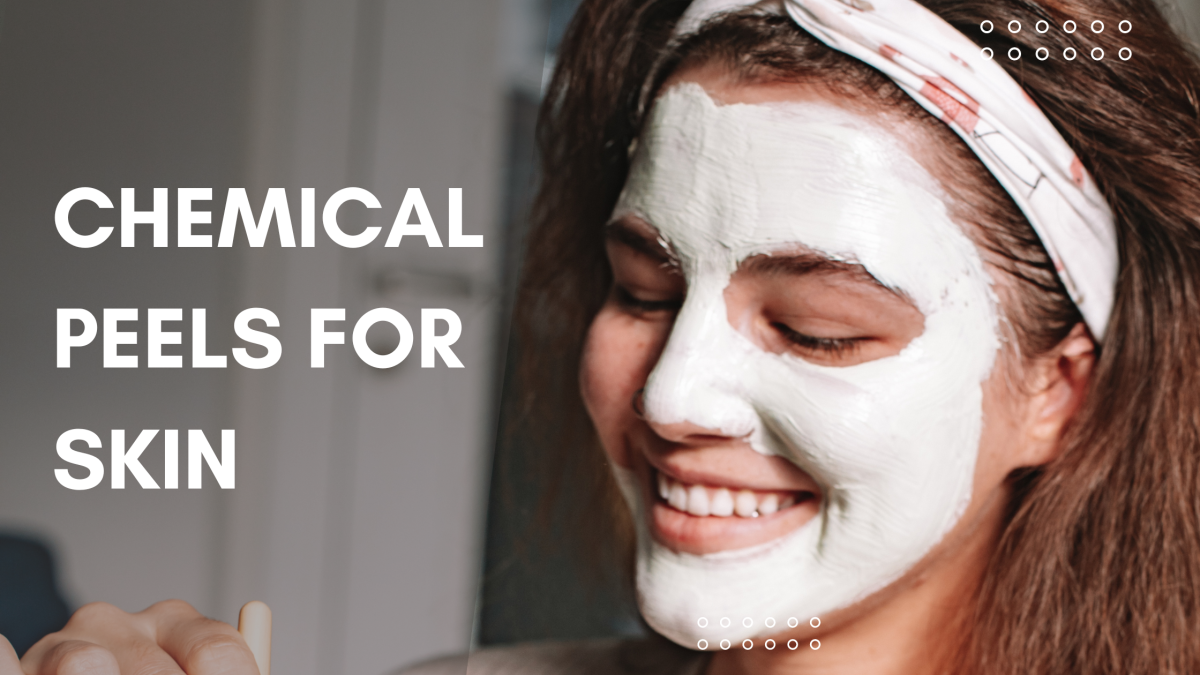 chemical peels for skin