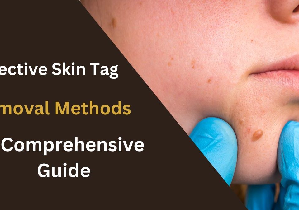 Effective Skin Tag Removal Methods