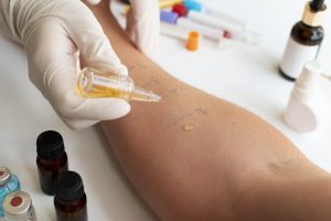 Patch testing of skincare products including glycolic acid