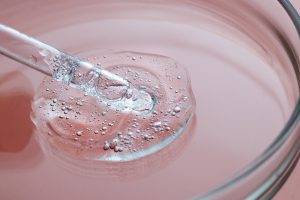 Close-up shot of lactic acid